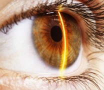 Ασφαλής η χρήση laser για τις παθήσεις των ματιών