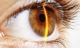 Ασφαλής η χρήση laser για τις παθήσεις των ματιών