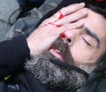 Διαδηλωτής των Κίτρινων Γιλέκων έχασε το μάτι του από χειροβομβίδα! (vid)