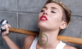 Δ. Γιάλβαλης: Παχυσαρκία και καρκίνος του θυρεοειδούς Δ. Γιάλβαλης: Παχυσαρκία και καρκίνος του θυρεοειδούς