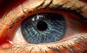 Ελπίδες σε τυφλούς δίνει τεχνητός αμφιβληστροειδής