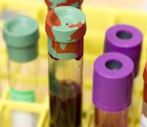 Ποια ομάδα αίματος κινδυνεύει λιγότερο από τον κοροναϊό (video) Ποια ομάδα αίματος κινδυνεύει λιγότερο από τον κοροναϊό (video)