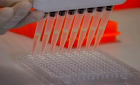 Chloroquine: Tο φάρμακο που θεραπεύει τον κοροναϊό Chloroquine: Tο φάρμακο που θεραπεύει τον κοροναϊό
