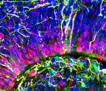 Οργανοειδής εγκέφαλος: Ανθρώπινα εγκεφαλικά κύτταρα σε προσομοίωση τύπου Matrix (vid)