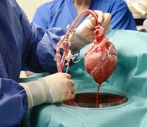 Έγινε για πρώτη φορά μεταμόσχευση καρδιάς από γουρούνι σε άνθρωπο (vid) Έγινε για πρώτη φορά μεταμόσχευση καρδιάς από γουρούνι σε άνθρωπο (vid)