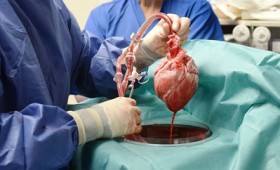 Έγινε για πρώτη φορά μεταμόσχευση καρδιάς από γουρούνι σε άνθρωπο (vid)