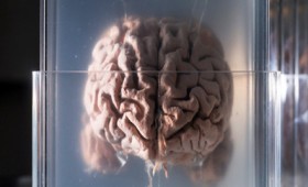 Η κλιματική αλλαγή συμβάλλει στη συρρίκνωση του ανθρώπινου εγκεφάλου Η κλιματική αλλαγή συμβάλλει στη συρρίκνωση του ανθρώπινου εγκεφάλου