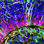 Οργανοειδής εγκέφαλος: Ανθρώπινα εγκεφαλικά κύτταρα σε προσομοίωση τύπου Matrix (vid)